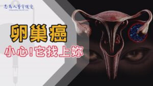 Read more about the article 【志為人醫守護愛】腹痛、腹脹、頻尿、食慾不振｜小心卵巢癌無聲潛伏！早期篩檢是預防關鍵