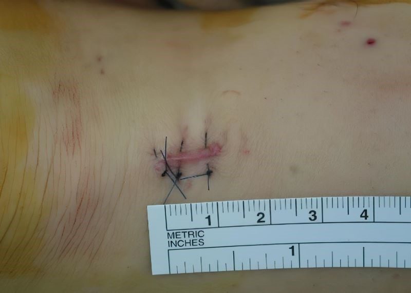 醫療品質獲肯定 台北慈濟醫院得SNQ銀獎認證 20260108 1