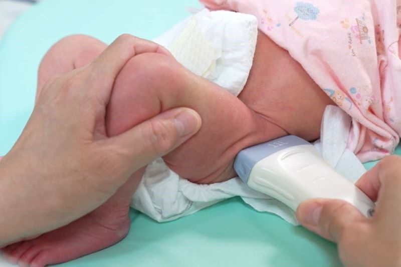 守護寶寶健康學步 台北慈院推動小兒髖關節超音波篩檢 20260402 3